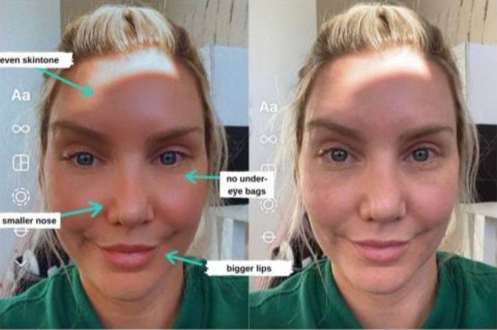 Social media filters have been proven to alter facial features on an individual based on the “idealized beauty standard.”