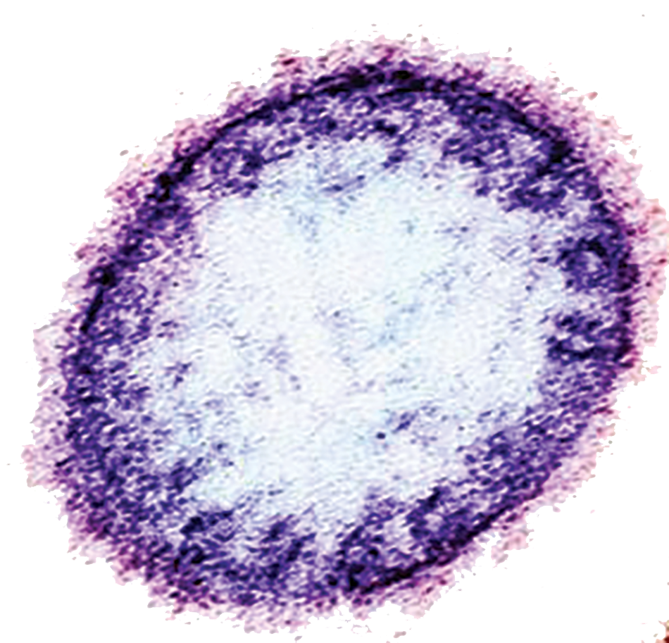 Nipah Virus, Harvard Medical School